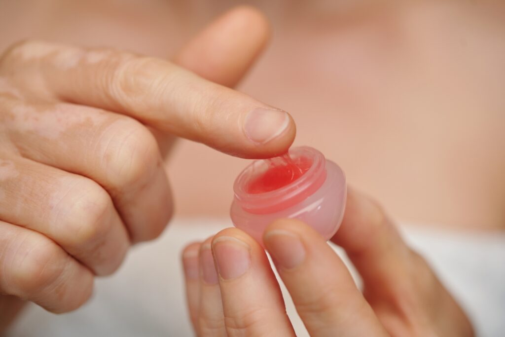Domowe sposoby na spierzchnięte usta – jak nawilżyć i złagodzić podrażnienia naturalnymi sposobami?